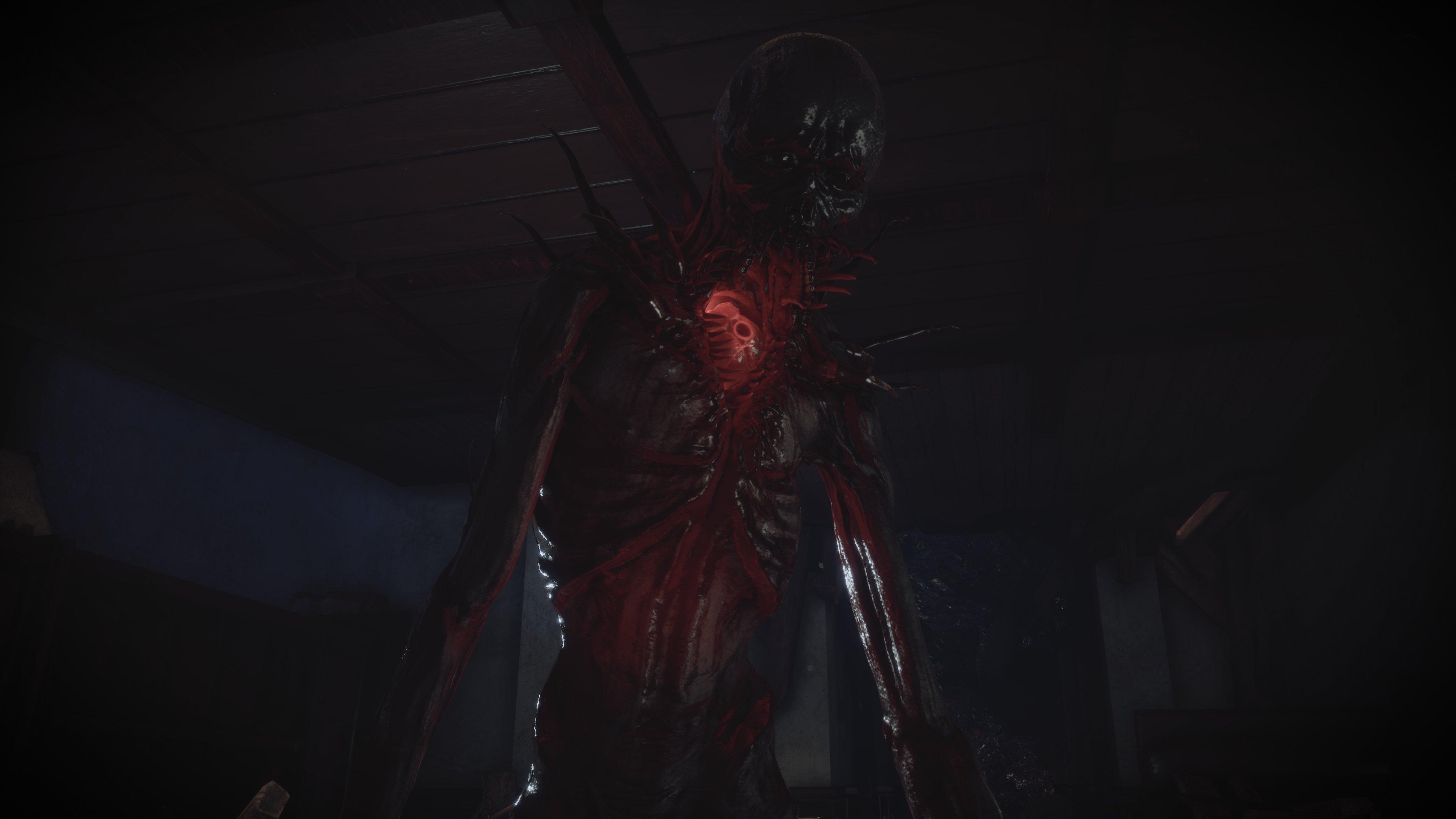 Fobia - St. Dinfna Hotel - Xbox Series X, Xbox One