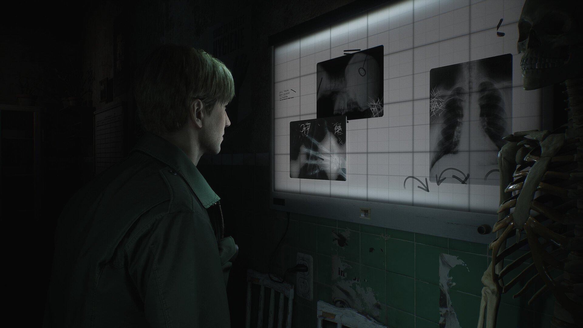 Silent Hill 2 Remake for PlayStation 5